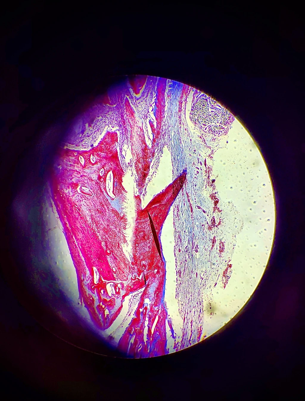 RCSI bone under microscope, photography print, research.