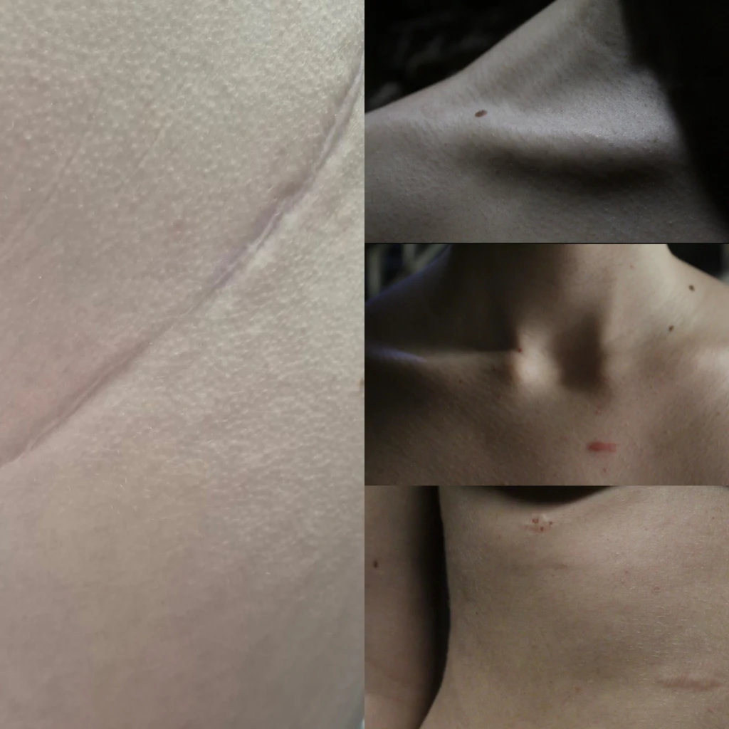 Primary research of series of photographs exploring surface pattern and traces left on the body.